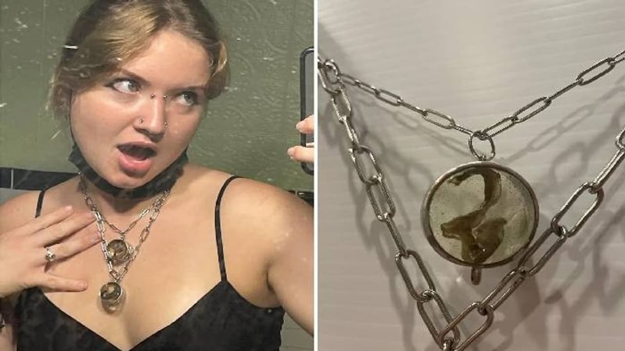 ഫാലോപ്യൻ ട്യൂബുകൾ നെക്ലേസാക്കി മാറ്റി കഴുത്തിൽ അണിഞ്ഞ് 22 കാരി; കാരണം ഇതാണ് ഫാലോപ്യൻ ട്യൂബുകൾ നെക്ലേസാക്കി മാറ്റി കഴുത്തിൽ അണിഞ്ഞ് 22 കാരി; കാരണം ഇതാണ്