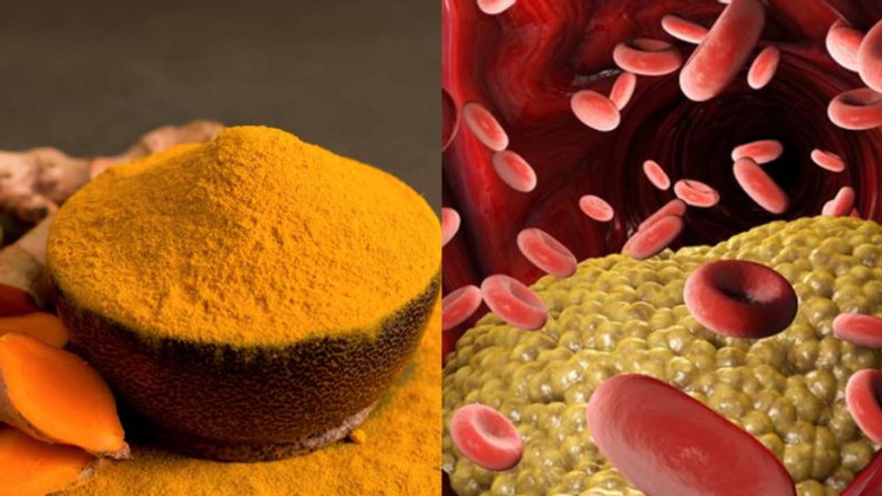 മഞ്ഞളിന് മോശം കൊളസ്ട്രോൾ കുറയ്ക്കാനുള്ള കഴിവുണ്ടോ? മഞ്ഞളിന് മോശം കൊളസ്ട്രോൾ കുറയ്ക്കാനുള്ള കഴിവുണ്ടോ?