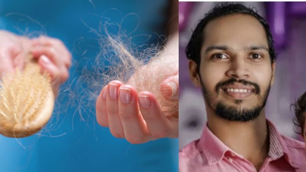 ಕೇರಳದ ಒಂದು ಮೊಟ್ಟೆಯ ಕಥೆ: ಕೂದಲು ಬರಲಿಲ್ಲವೆಂದು ವೈದ್ಯನ ಹೆಸರು ಬರೆದಿಟ್ಟು ಸೂಸೈಡ್‌..!