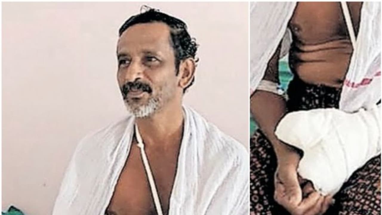 ഗൃഹനാഥന് നേരെ കാട്ടുപന്നിയുടെ ആക്രമണം, കൈവിരൽ കടിച്ചെടുത്തു ഗൃഹനാഥന് നേരെ കാട്ടുപന്നിയുടെ ആക്രമണം, കൈവിരൽ കടിച്ചെടുത്തു