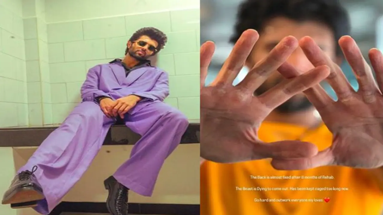 विजय देवरकोंडा ने दिखाए कटे फटे हाथ, 8 महीने के इलाज के बाद अब कर रहे वापसी विजय देवरकोंडा ने दिखाए कटे फटे हाथ, 8 महीने के इलाज के बाद अब कर रहे वापसी