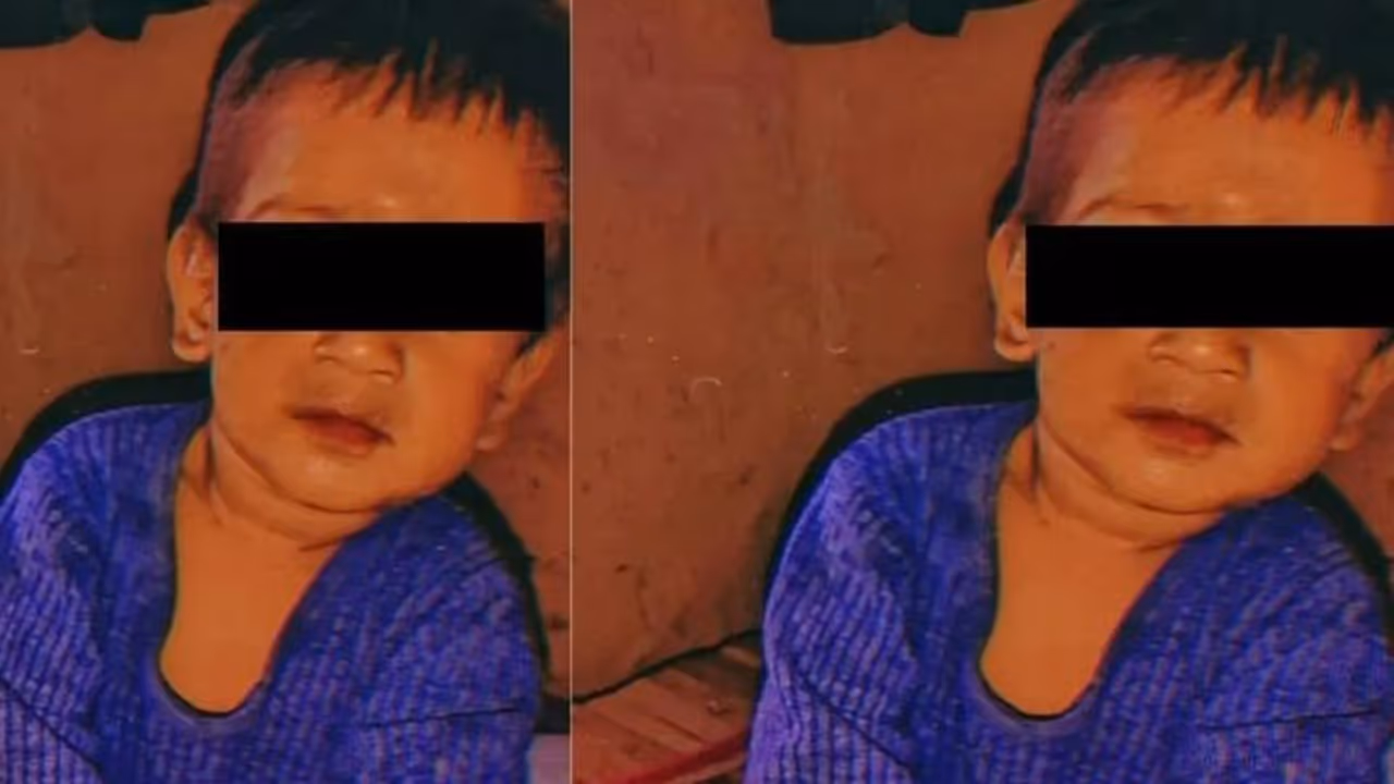 ಇರುವೆ ಕಚ್ಚಿ ಮೂರು ವರ್ಷದ ಪುಟಾಣಿ ಸಾವು, ಸಹೋದರ ಅಸ್ವಸ್ಥ