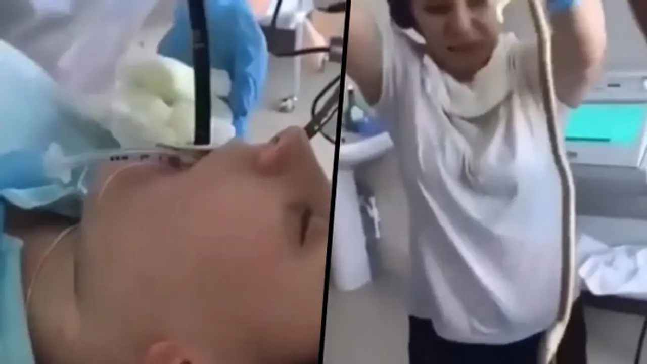 Russian doctors pull out 4 feet long snake from woman's mouth; horrifying video goes viral Russian doctors pull out 4 feet long snake from woman's mouth; horrifying video goes viral