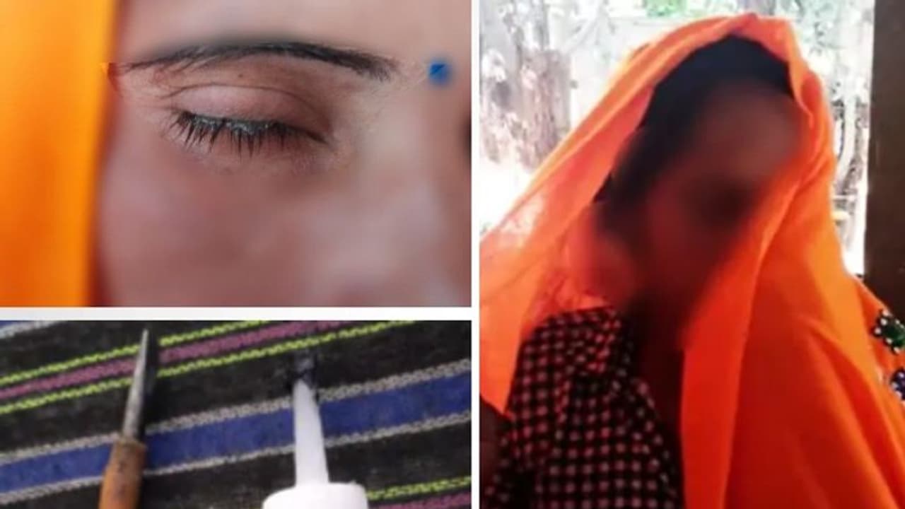 भतीजे ने चाची के होंठ और आंख पर फेवीक्विक चिपकाकर की छेड़छाड़, वो ना बोली पा रहीं और ना ही देख पा रहीं भतीजे ने चाची के होंठ और आंख पर फेवीक्विक चिपकाकर की छेड़छाड़, वो ना बोली पा रहीं और ना ही देख पा रहीं