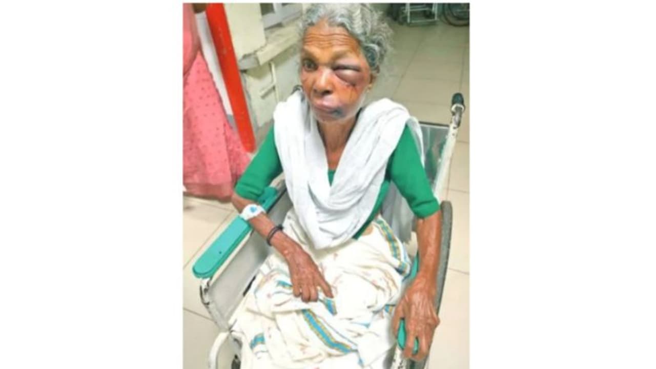 വെള്ളം ചോദിച്ചെത്തിയ യുവാവ് വൃദ്ധയുടെ മുഖത്തടിച്ച് ശേഷം മാല പൊട്ടിച്ച് കടന്നു വെള്ളം ചോദിച്ചെത്തിയ യുവാവ് വൃദ്ധയുടെ മുഖത്തടിച്ച് ശേഷം മാല പൊട്ടിച്ച് കടന്നു