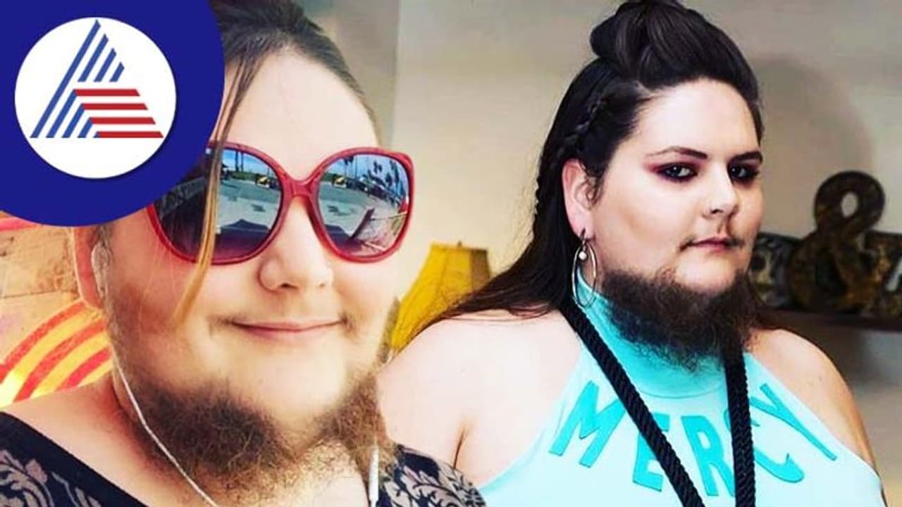 ಮುಖದಲ್ಲಿ ಕೂದಲಿದೆ ಅಂತ ಶೇವ್ ಮಾಡ್ಬೇಡಿ..ಇಲ್ಲೊಬ್ಬ ಮಹಿಳೆಗೆ ಗಡ್ಡವೇ ಬಂತು ನೋಡಿ