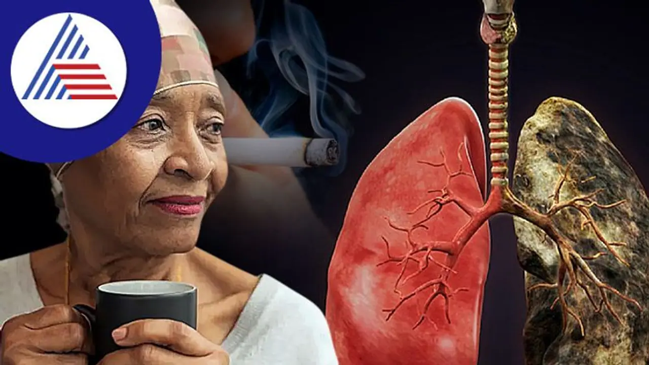 ಧಮ್ ಎಳೆಯದೇ ಹೋದ್ರೂ ಮಹಿಳೆಯರನ್ನು ಹೆಚ್ಚು ಕಾಡ್ತಿದೆ Lung Cancer