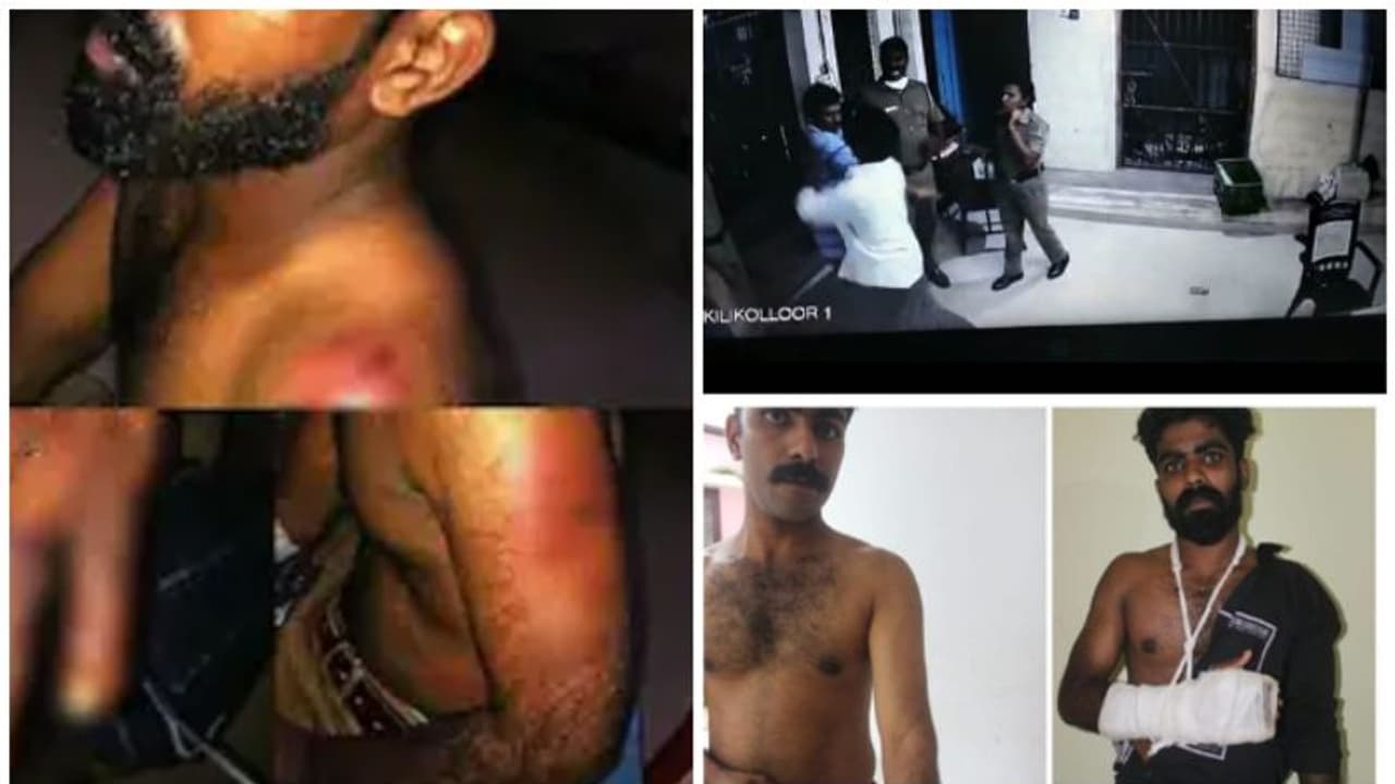 'മർദ്ദനം സ്റ്റേഷനിൽ വെച്ച്, മർദ്ദിച്ചത് ആരാണെന്നറിയില്ല'; കിളികൊല്ലൂർ കേസിൽ പൊലീസിനെ സംരക്ഷിച്ച് റിപ്പോർട്ട്