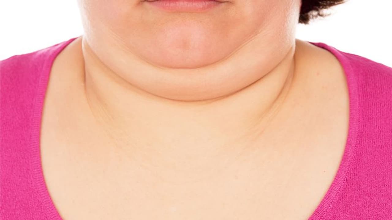 डबल चिन के चलते आपके चेहरे का शेप भी बिगड़ गया है, तो इस तरह पाएं परफेक्ट जॉलाइन डबल चिन के चलते आपके चेहरे का शेप भी बिगड़ गया है, तो इस तरह पाएं परफेक्ट जॉलाइन