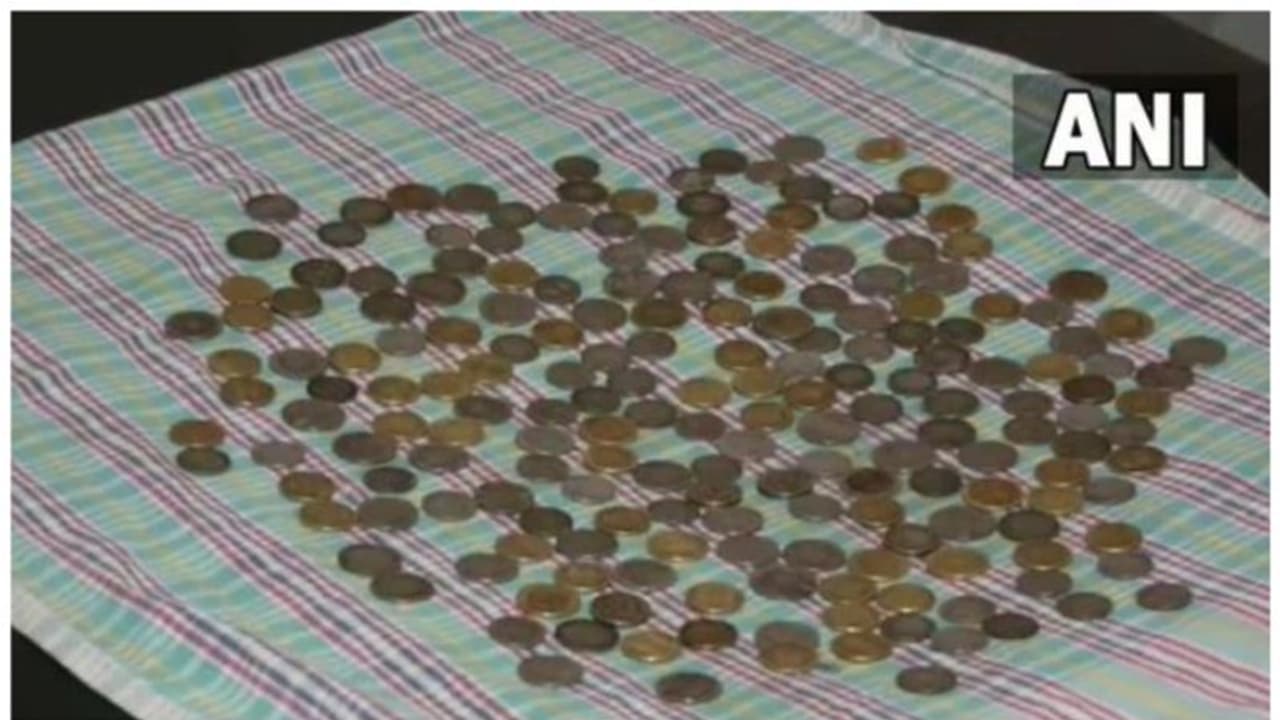 58കാരന്റെ വയറ്റില് നിന്ന് ഡോക്ടര്മാര് നീക്കം ചെയ്തത് 187 നാണയങ്ങള് 58കാരന്റെ വയറ്റില് നിന്ന് ഡോക്ടര്മാര് നീക്കം ചെയ്തത് 187 നാണയങ്ങള്