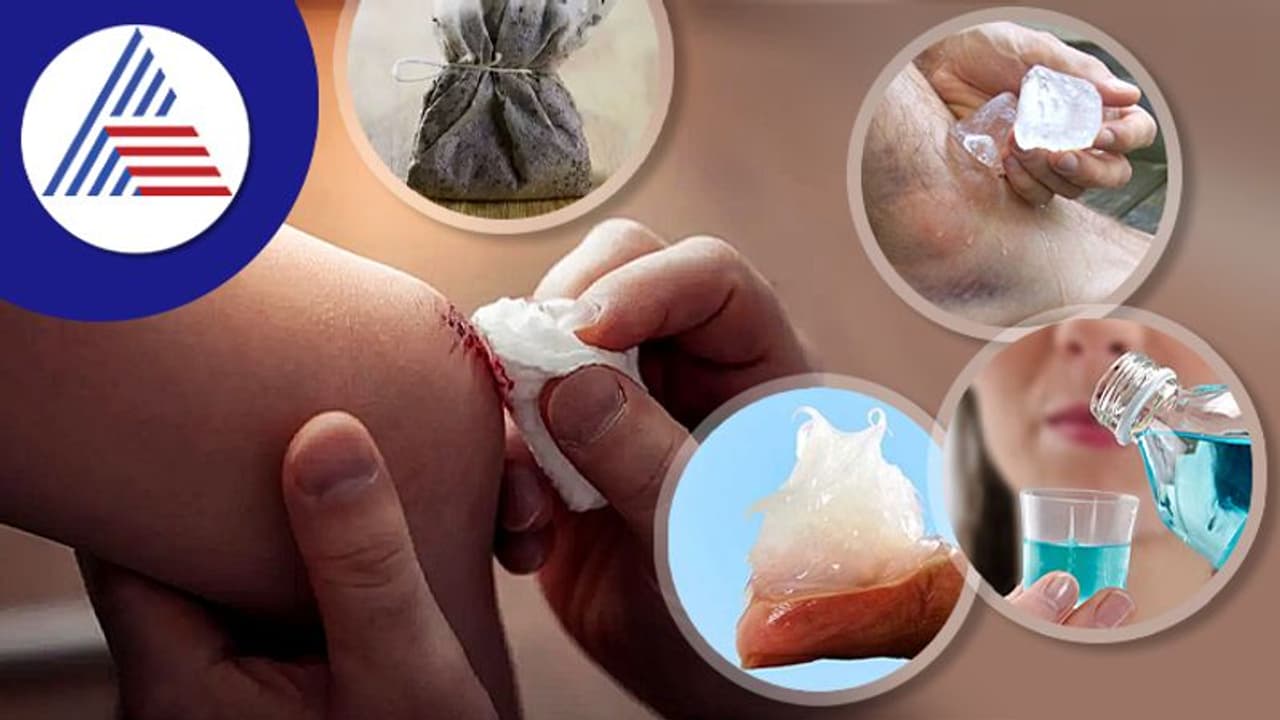 Health Tips: ಗಾಯದ ರಕ್ತಸ್ರಾವ ತಡೆಯುತ್ತೆ ಮನೆಯಲ್ಲಿರುವ ಈ ವಸ್ತು Health Tips: ಗಾಯದ ರಕ್ತಸ್ರಾವ ತಡೆಯುತ್ತೆ ಮನೆಯಲ್ಲಿರುವ ಈ ವಸ್ತು