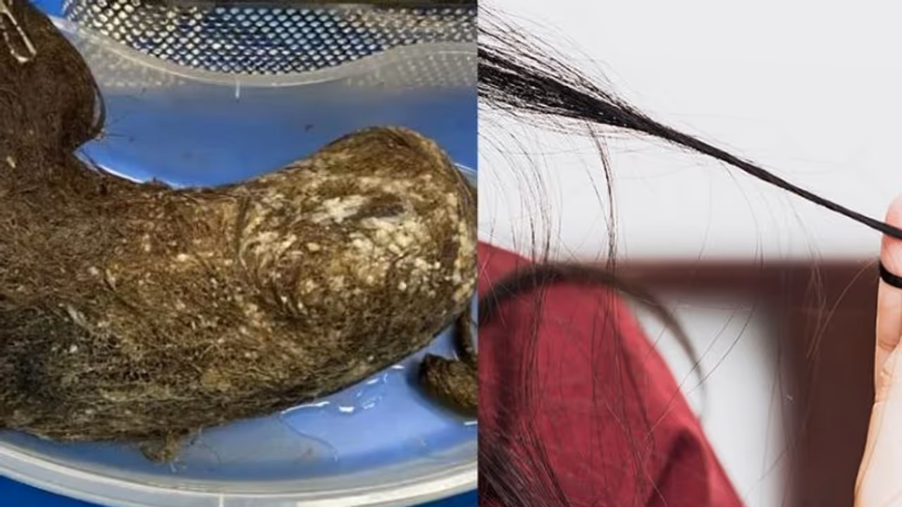 தலைமுடியை கடித்து சாப்பிடும் விநோத பழக்கம் ஏற்படுவது ஏன்..? தலைமுடியை கடித்து சாப்பிடும் விநோத பழக்கம் ஏற்படுவது ஏன்..?