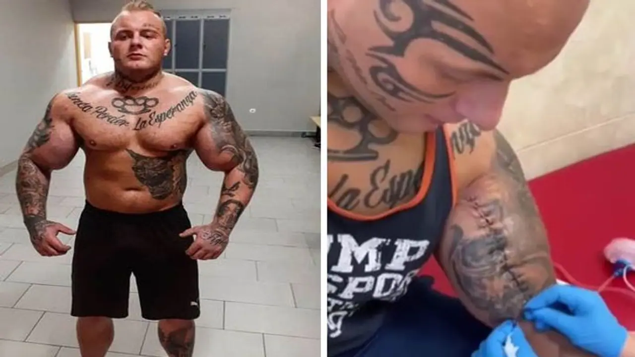 बाइसेप्स को और बढ़ाने के चक्कर में फट गया हाथ, बॉडी बिल्डर ने कर ली थी ये गलती बाइसेप्स को और बढ़ाने के चक्कर में फट गया हाथ, बॉडी बिल्डर ने कर ली थी ये गलती