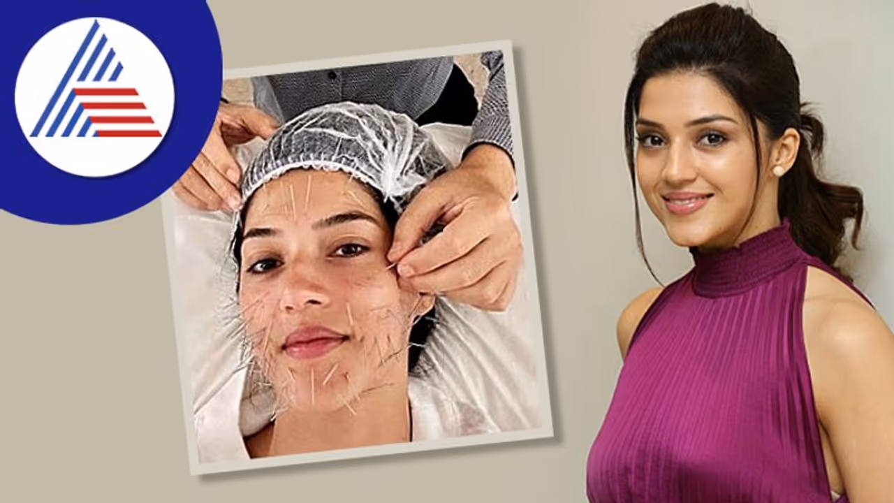 ಅಯ್ಯೋ ಈ ನಟಿಗೆ ಏನಾಯ್ತು..! ಮೆಹ್ರೀನ್ ಕೌರ್ ಮುಖದ ತುಂಬಾ ಸೂಜಿಗಳನ್ನು ನೋಡಿ ಫ್ಯಾನ್ಸ್ ಶಾಕ್ ಅಯ್ಯೋ ಈ ನಟಿಗೆ ಏನಾಯ್ತು..! ಮೆಹ್ರೀನ್ ಕೌರ್ ಮುಖದ ತುಂಬಾ ಸೂಜಿಗಳನ್ನು ನೋಡಿ ಫ್ಯಾನ್ಸ್ ಶಾಕ್