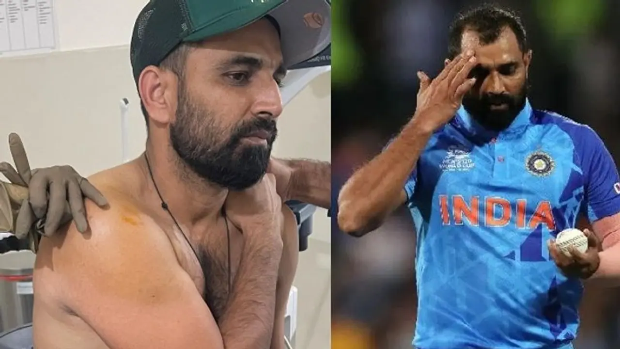 Bangladesh vs India 2022: Injured Shami ruled out of ODIs, Umran Malik to replace him Bangladesh vs India 2022: Injured Shami ruled out of ODIs, Umran Malik to replace him