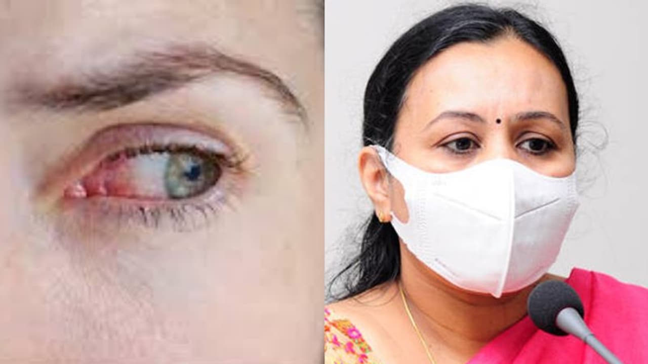 ചെങ്കണ്ണ് ശ്രദ്ധിച്ചില്ലെങ്കില് സങ്കീര്ണമാവാം, കുട്ടികള്ക്ക് കൂടുതല് കരുതല് വേണം; ആരോഗ്യമന്ത്രി ചെങ്കണ്ണ് ശ്രദ്ധിച്ചില്ലെങ്കില് സങ്കീര്ണമാവാം, കുട്ടികള്ക്ക് കൂടുതല് കരുതല് വേണം; ആരോഗ്യമന്ത്രി