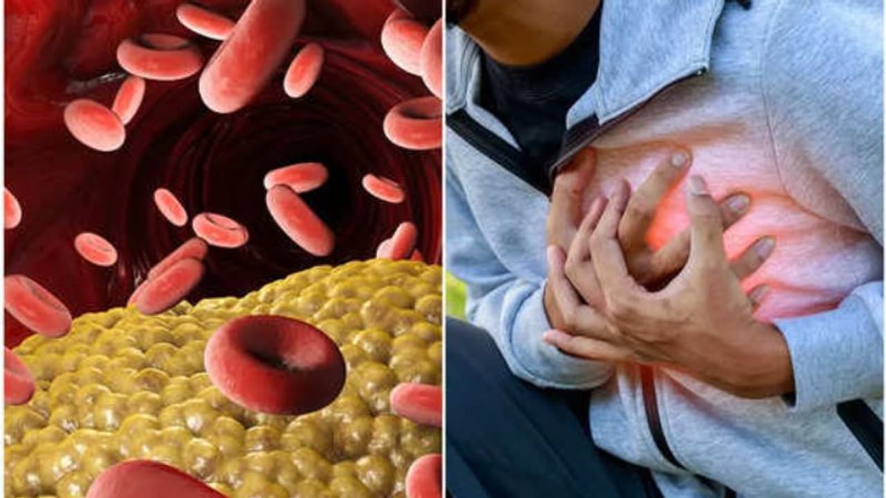 കൊളസ്ട്രോളിനെ എങ്ങനെ നിയന്ത്രിക്കാം? തിരിച്ചറിയണം ഈ അപകടസാധ്യതകൾ...