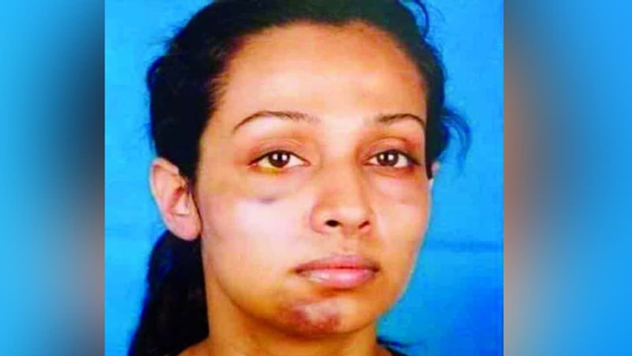 ब्वॉयफ्रेंड ने इतना मारा टूट गया था गंदी बात एक्ट्रेस का जबड़ा,खोला BF की करतूतों का काला चिट्ठा ब्वॉयफ्रेंड ने इतना मारा टूट गया था गंदी बात एक्ट्रेस का जबड़ा,खोला BF की करतूतों का काला चिट्ठा