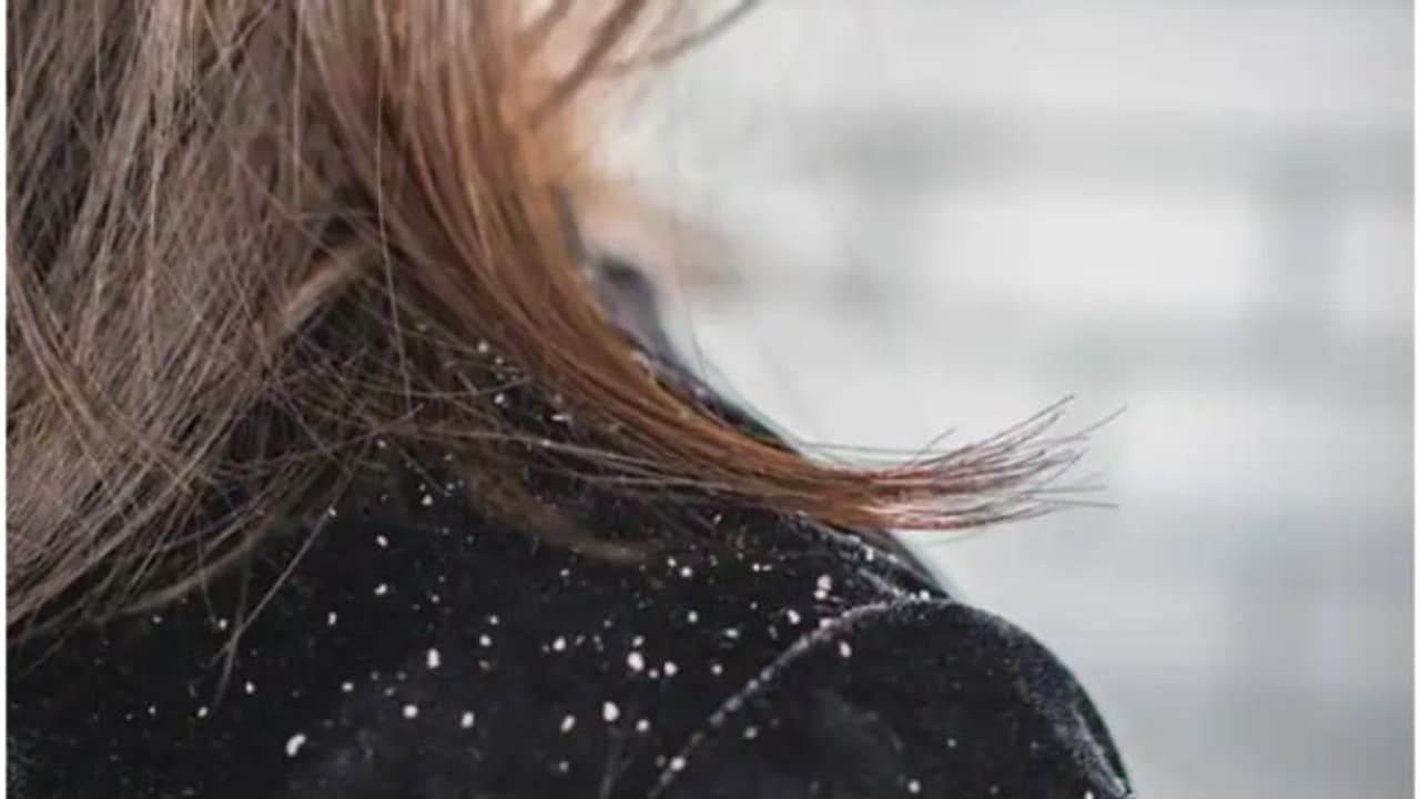 മഞ്ഞുകാലത്തെ തലമുടി സംരക്ഷണം; ഡയറ്റില് ഉള്പ്പെടുത്താം ഈ ഭക്ഷണങ്ങള്... മഞ്ഞുകാലത്തെ തലമുടി സംരക്ഷണം; ഡയറ്റില് ഉള്പ്പെടുത്താം ഈ ഭക്ഷണങ്ങള്...