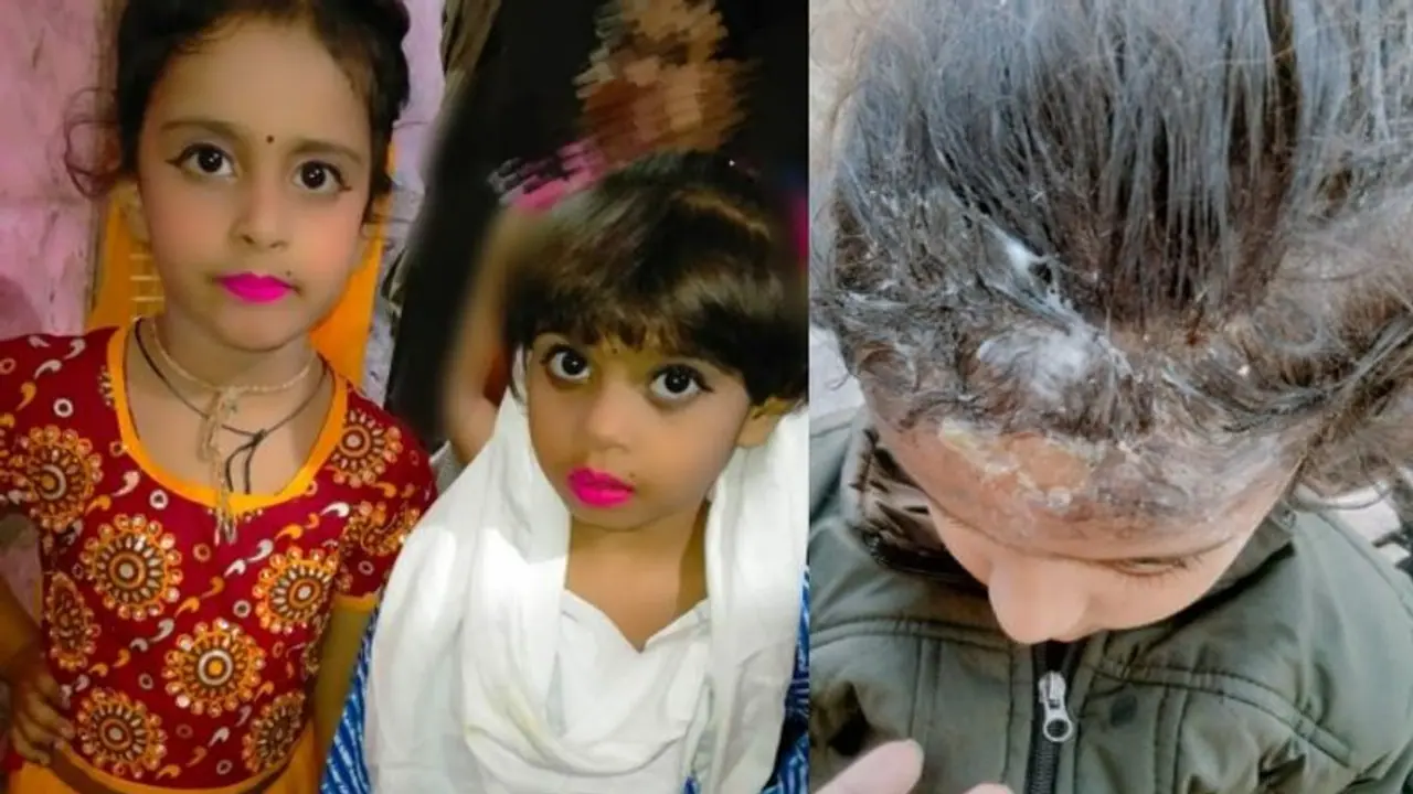 दर्दनाक खबर: 8 साल की बच्ची की मां ने 5 और 7 साल की बच्चियों पर डाला खौलता पानी, दर्द से तड़पती रही मासूम दर्दनाक खबर: 8 साल की बच्ची की मां ने 5 और 7 साल की बच्चियों पर डाला खौलता पानी, दर्द से तड़पती रही मासूम