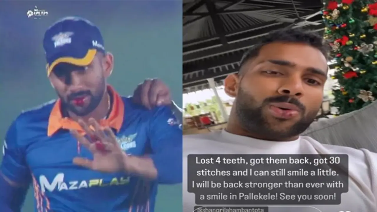 एक कैच लेने के दौरान टूट गए क्रिकेटर के 4 दांत, 30 टांके आए ऐसी हो गई हालत एक कैच लेने के दौरान टूट गए क्रिकेटर के 4 दांत, 30 टांके आए ऐसी हो गई हालत