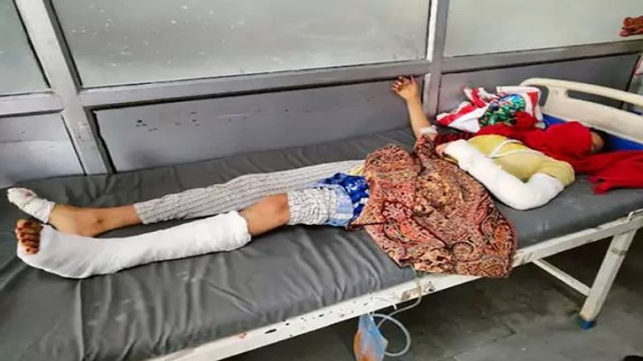 चाचा की गंदी नीयत से बचने के लिए युवती छत से कूदी तो टूट गए हाथ पैर, आरोपी को डराने के लिए अपनाए कई तरीके