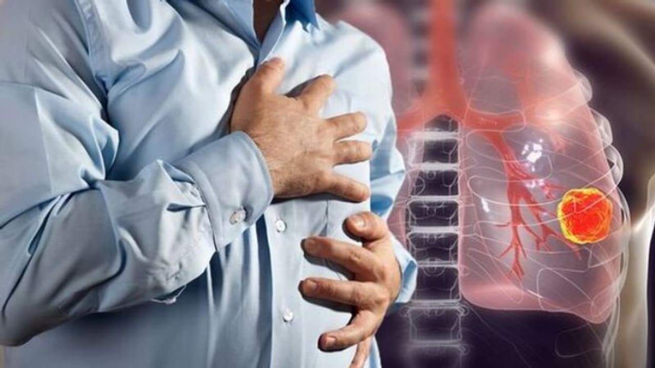 ശ്വാസകോശ ക്യാന്‍സര്‍ ഗുരുതരമാകുമ്പോഴാണ് പലരും തിരിച്ചറിയുന്നത്; അറിയാം ഈ ലക്ഷണങ്ങൾ...