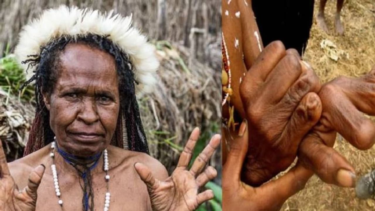 പ്രിയപ്പെട്ടവർ മരിച്ചാൽ ഇവിടെ സ്ത്രീകളുടെ വിരലുകൾ മുറിച്ചു കളയും