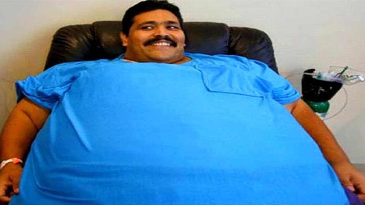 पत्नी ने छोड़ा तो 444kg के पुलिस ऑफिसर ने सर्जरी से घटाया था वजन, लेकिन वजन घटते ही हो गई मौत पत्नी ने छोड़ा तो 444kg के पुलिस ऑफिसर ने सर्जरी से घटाया था वजन, लेकिन वजन घटते ही हो गई मौत