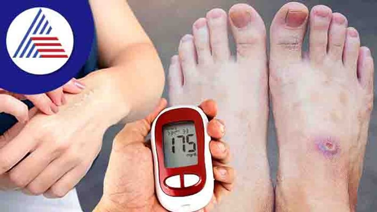 ಡಯಾಬಿಟಿಸ್‌ ಪೇಷೆಂಟ್ಸ್‌ ಗಾಯ ವಾಸಿಗೆ ಯಾಕೆ ಹೆಚ್ಚು ಸಮಯ ತೆಗೆದುಕೊಳ್ಳುತ್ತೆ ?