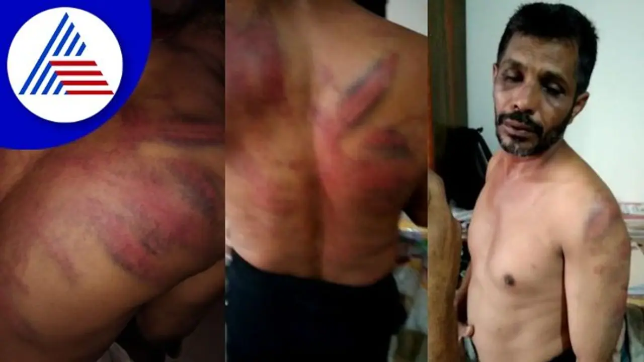 Mangaluru; ಮತ್ತೆ ನೈತಿಕ ಪೊಲೀಸ್ ಗಿರಿ, ಮರಕ್ಕೆ ಕಟ್ಟಿ ಕಾರ್ಮಿಕನಿಗೆ ಥಳಿತ 