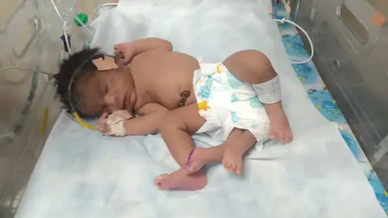 ग्वालियर में 4 पैरों वाली बच्ची ने लिया जन्म, कोई कह रहा चमत्कार तो कोई बता रहा देवी का अवतार ग्वालियर में 4 पैरों वाली बच्ची ने लिया जन्म, कोई कह रहा चमत्कार तो कोई बता रहा देवी का अवतार