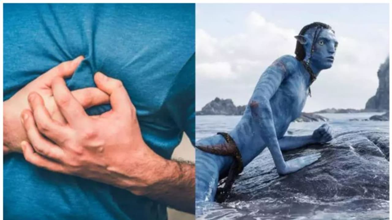 അവതാർ 2 കാണുന്നതിനിടെ യുവാവ് ഹൃദയാഘാതം മൂലം മരിച്ചതായി റിപ്പോർട്ടുകൾ ; ഡോക്ടർമാർ പറയുന്നത്... അവതാർ 2 കാണുന്നതിനിടെ യുവാവ് ഹൃദയാഘാതം മൂലം മരിച്ചതായി റിപ്പോർട്ടുകൾ ; ഡോക്ടർമാർ പറയുന്നത്...