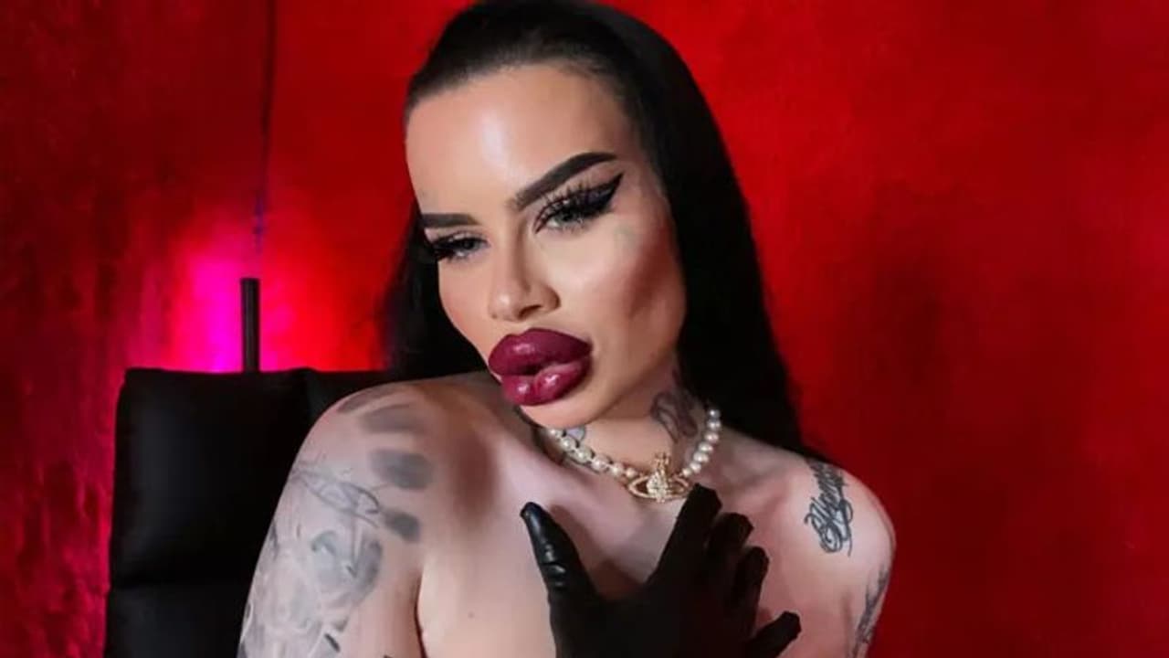 हाय रे शौक! 40 लाख रुपए खर्च कर इन मैडम ने बिगाड़ दी चेहरे का लुक, अभी भी नहीं हैं रुकने वाली