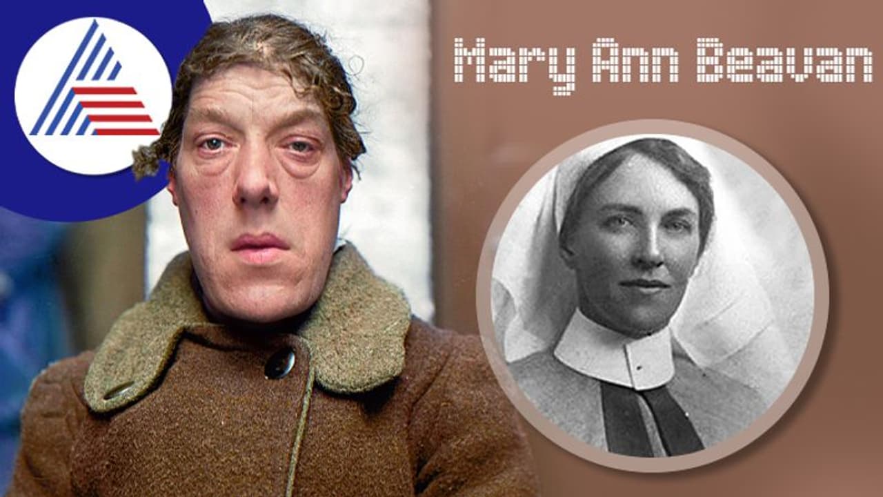 ವಿಶ್ವದ Ugly Woman ಯಾರು ಗೊತ್ತಾ? ಅದ್ಯಾಕೆ ಇವರನ್ನು ಕುರೂಪಿ ಅಂತಾರೆ?