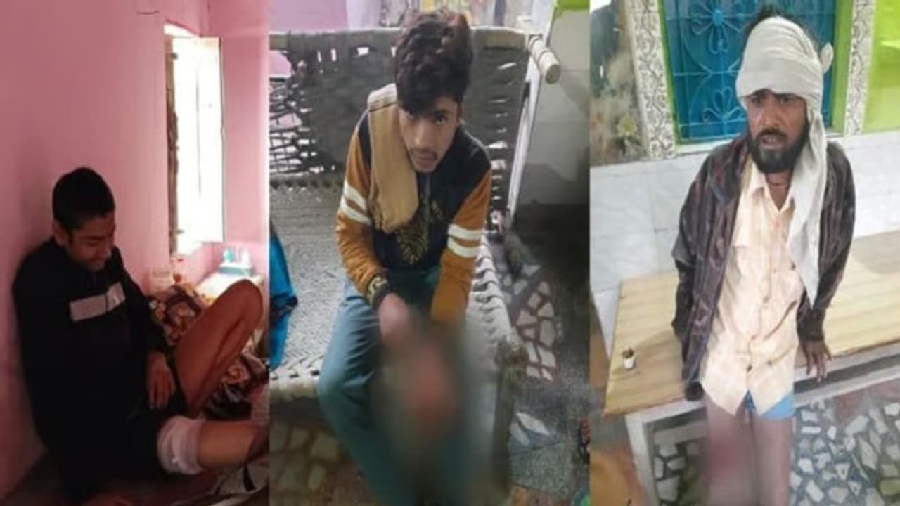 आगरा में एक ही दिन में कुत्ते ने 28 लोगों पर किया हमला, लोगों ने बेजुबान को दी दर्दनाक मौत