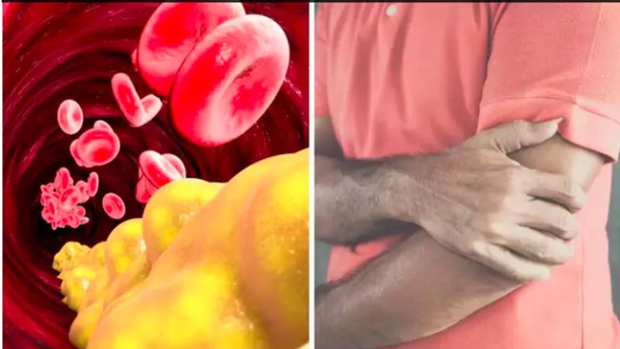 കൊളസ്ട്രോള്‍ കുറയ്ക്കാന്‍ പരീക്ഷിക്കാം ഈ അഞ്ച് കാര്യങ്ങള്‍... 