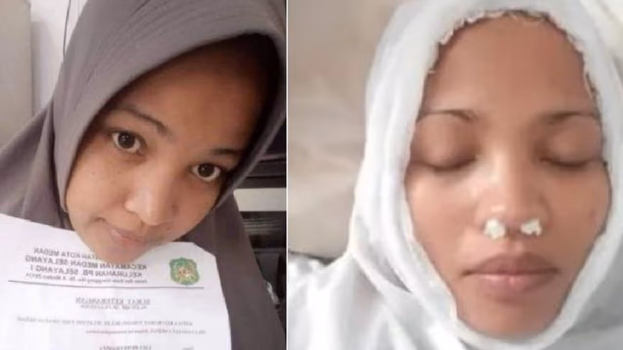 ಸಾಲಗಾರರಿಂದ ತಪ್ಪಿಸಿಕೊಳ್ಳಲು ಮೂಗಿಗೆ ಹತ್ತಿ ಇಟ್ಟು ಫೇಸ್‌ಬುಕ್‌ಗೆ ಫೋಟೋ ಹಾಕಿದ ಮಹಿಳೆ