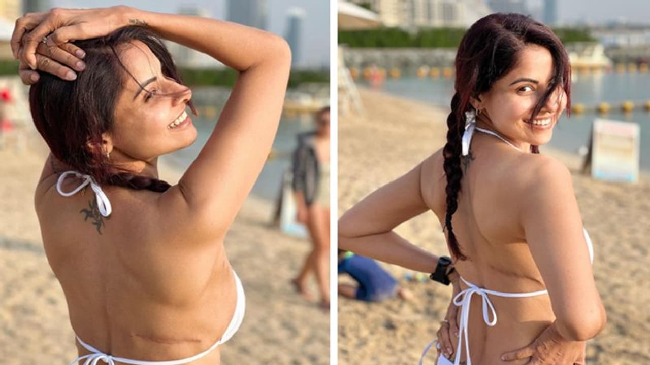 छवि मित्तल ने दिखाए ब्रेस्ट कैंसर सर्जरी के निशान, बिकिनी में PHOTOS शेयर कर खुद को बताया स्ट्रॉन्ग छवि मित्तल ने दिखाए ब्रेस्ट कैंसर सर्जरी के निशान, बिकिनी में PHOTOS शेयर कर खुद को बताया स्ट्रॉन्ग