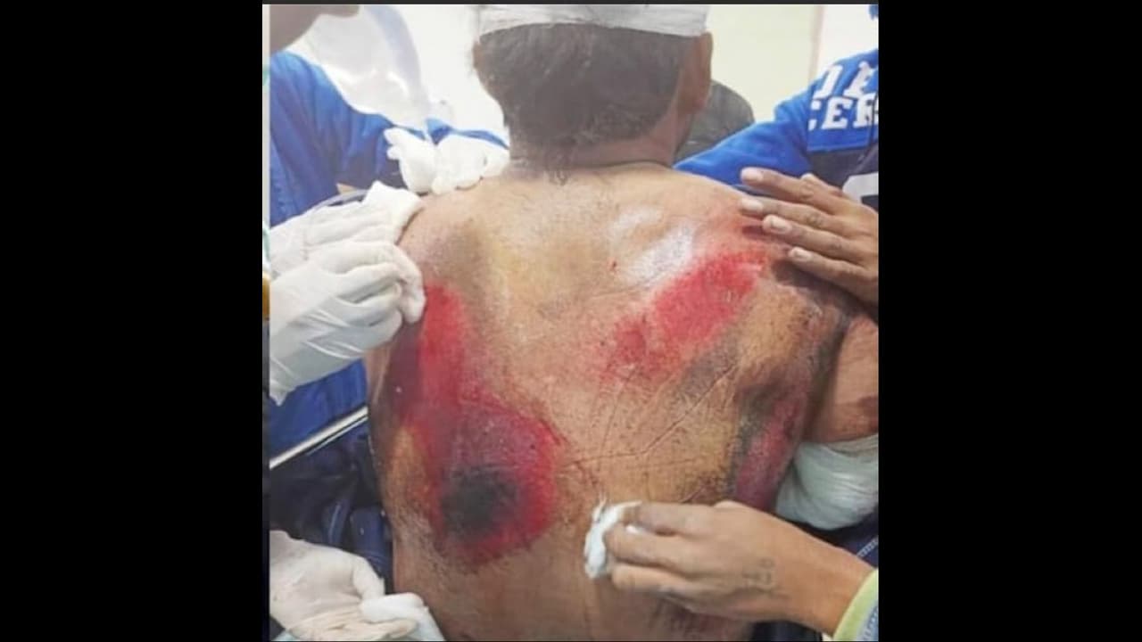 எலும்பியல் மற்றும் பிளாஸ்டிக் அறுவை சிகிச்சை நிபுணர்களின் கண்காணிப்பில் ரிஷப் பண்ட்: டேராடூன் மருத்துவர் ஆஷிஸ்