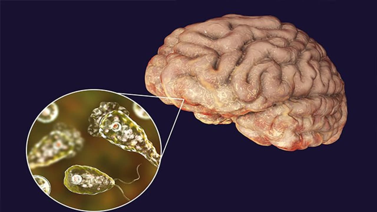 What is Brain eating amoeba? Know its symptoms, prevention and chances of survival