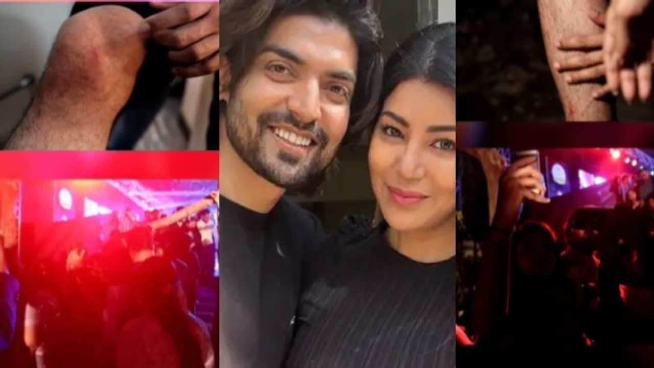 ಹೊಸ ವರ್ಷಾಚರಣೆ ವೇಳೆ ಪತ್ನಿಯನ್ನು ರಕ್ಷಿಸಲು ಹೋಗಿ ಗಾಯಗೊಂಡ ನಟ ಗುರ್ಮೀತ್ ಚೌಧರಿ; ಸಖತ್ ಟ್ರೋಲ್