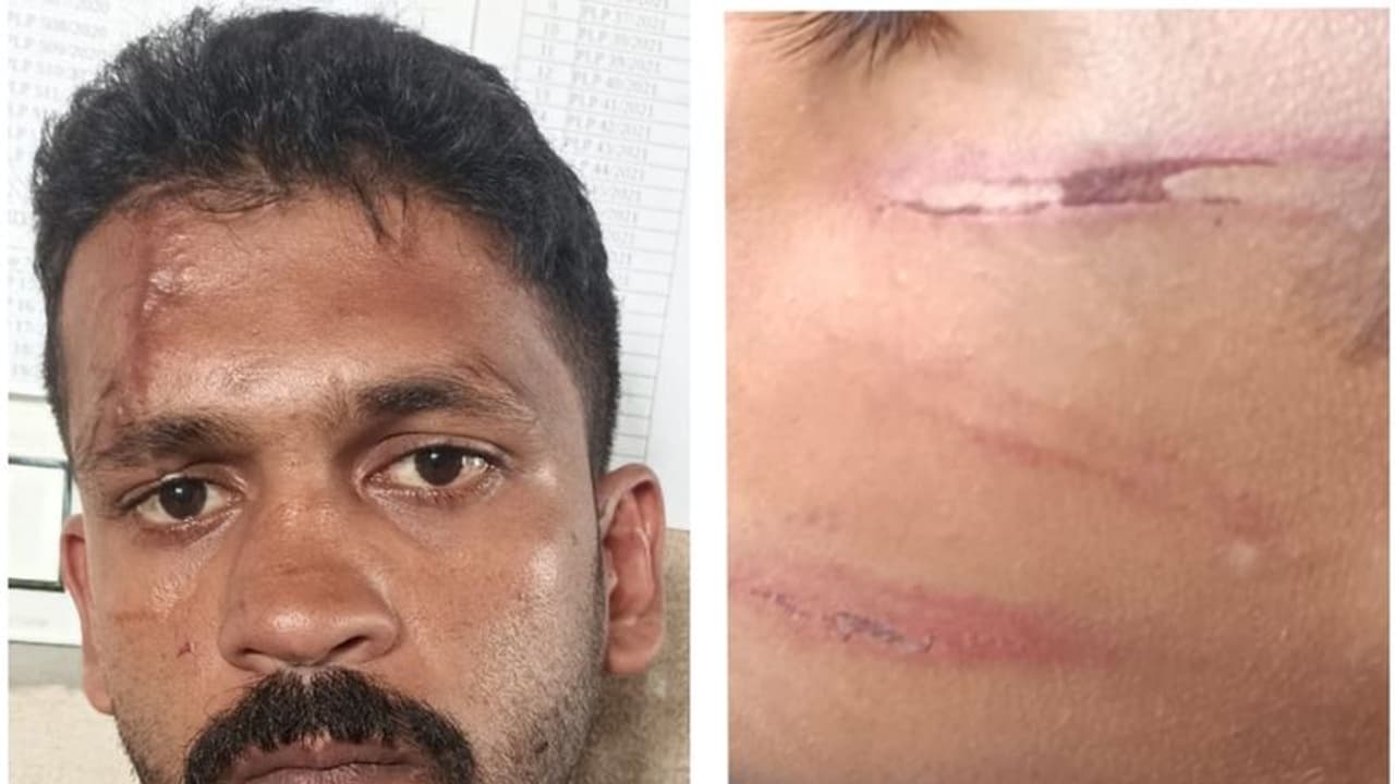 മൂന്നര വയസുള്ള കുട്ടിയെ മര്ദ്ദിച്ച കേസില് ജാമ്യം; വീണ്ടും അതേ കുറ്റത്തിന് പ്രതി അറസ്റ്റില് മൂന്നര വയസുള്ള കുട്ടിയെ മര്ദ്ദിച്ച കേസില് ജാമ്യം; വീണ്ടും അതേ കുറ്റത്തിന് പ്രതി അറസ്റ്റില്