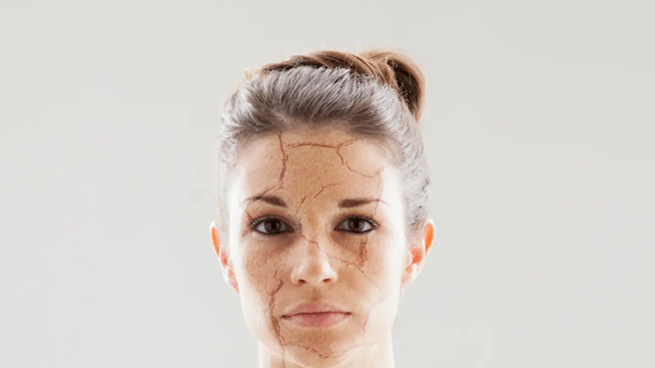 Dry Skincare Dry Skincare