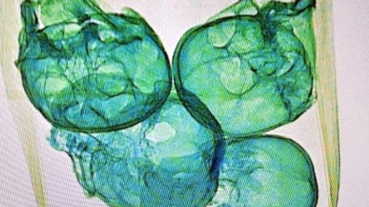 വിചിത്രമായ ഒരു സമ്മാനപ്പൊതി, അതു തുറന്ന എയര്പോര്ട്ട് ഉദ്യോഗസ്ഥര് വിറച്ചുപോയി! വിചിത്രമായ ഒരു സമ്മാനപ്പൊതി, അതു തുറന്ന എയര്പോര്ട്ട് ഉദ്യോഗസ്ഥര് വിറച്ചുപോയി!