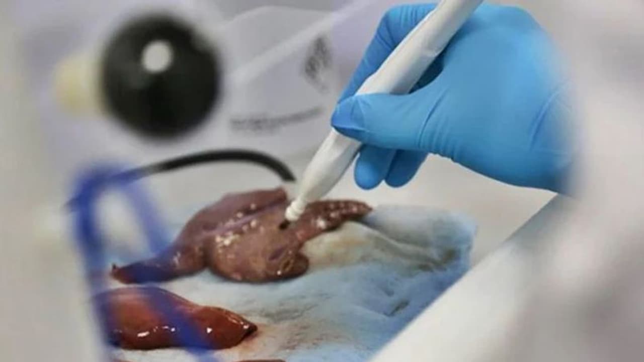 आ गया चमत्कारी सर्जिकल चाकू, जो ट्यूमर को 'सूंघकर' सेकंडों में कैंसर का लगाएगी पता आ गया चमत्कारी सर्जिकल चाकू, जो ट्यूमर को 'सूंघकर' सेकंडों में कैंसर का लगाएगी पता