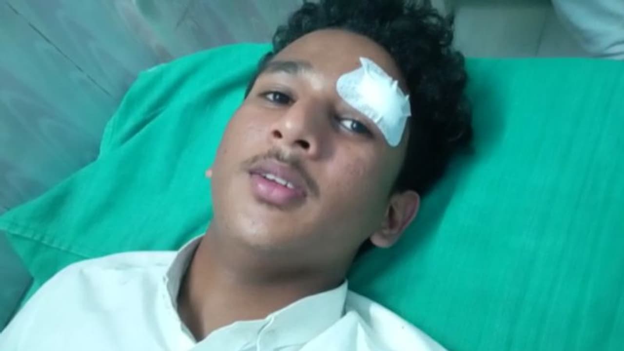 തൃശ്ശൂരിൽ ഷൂ ധരിച്ച് വന്ന പ്ലസ് വൺ വിദ്യാർത്ഥിയെ 30 ഓളം വിദ്യാർത്ഥികൾ ചേർന്ന് മർദ്ദിച്ചു തൃശ്ശൂരിൽ ഷൂ ധരിച്ച് വന്ന പ്ലസ് വൺ വിദ്യാർത്ഥിയെ 30 ഓളം വിദ്യാർത്ഥികൾ ചേർന്ന് മർദ്ദിച്ചു