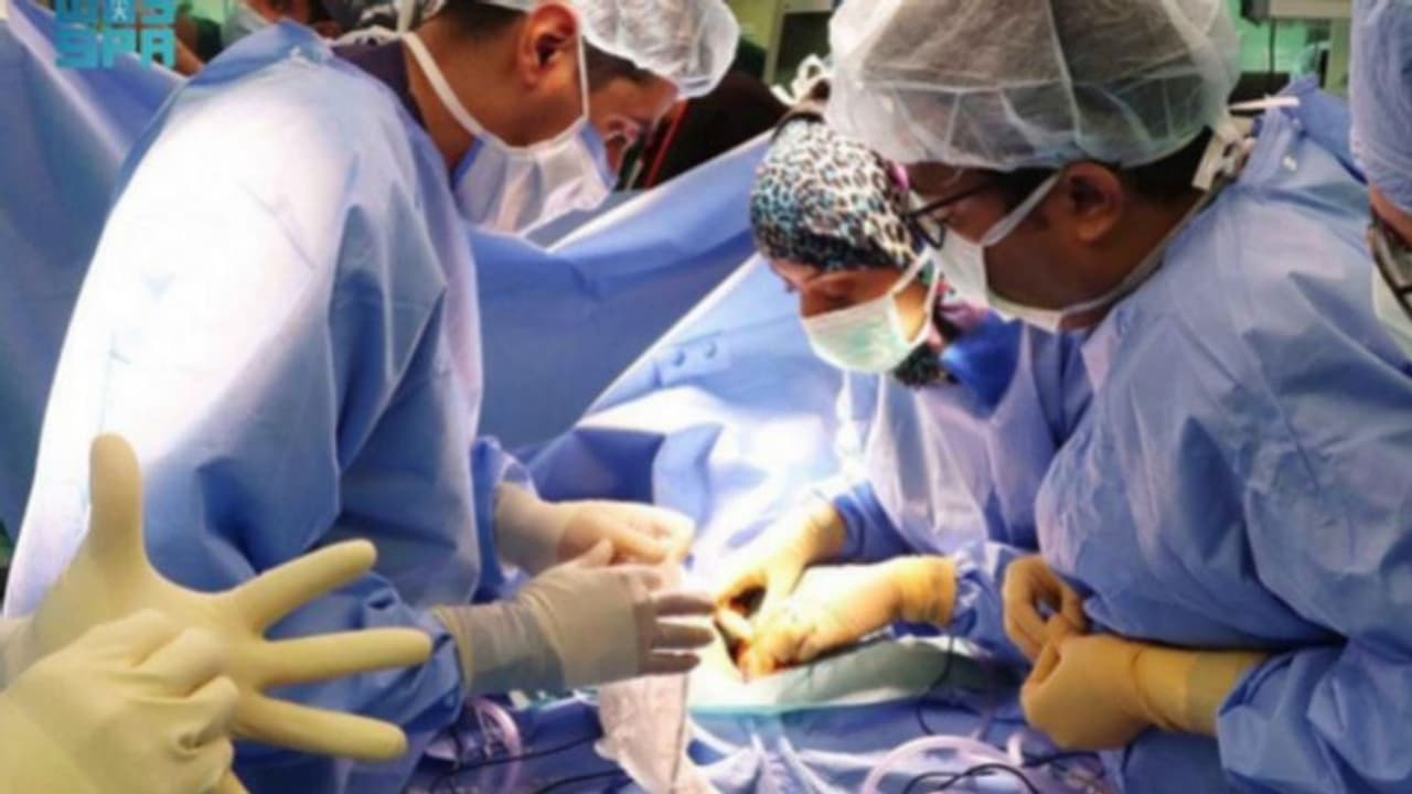 സൗദി അറേബ്യയില്‍ സയാമിസ് ഇരട്ടകളെ വിജയകരമായി വേർപ്പെടുത്തി