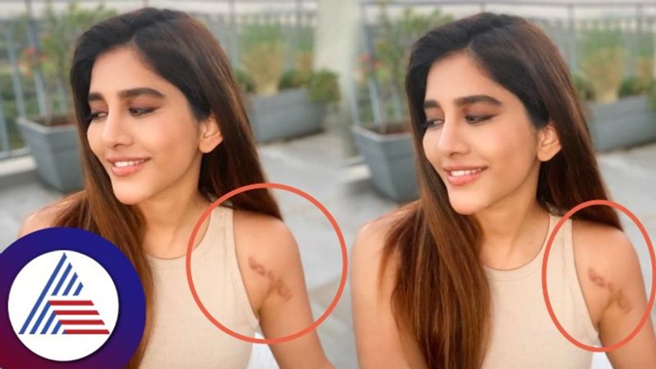 ಭೀಕರ ಅಪಘಾತದಿಂದ ಮೂರ್ನಾಲ್ಕು ಅಪರೇಷನ್ಗೆ ಒಳಗಾದ ನಟಿ ನಭಾ ನಟೇಶ್ ಭೀಕರ ಅಪಘಾತದಿಂದ ಮೂರ್ನಾಲ್ಕು ಅಪರೇಷನ್ಗೆ ಒಳಗಾದ ನಟಿ ನಭಾ ನಟೇಶ್