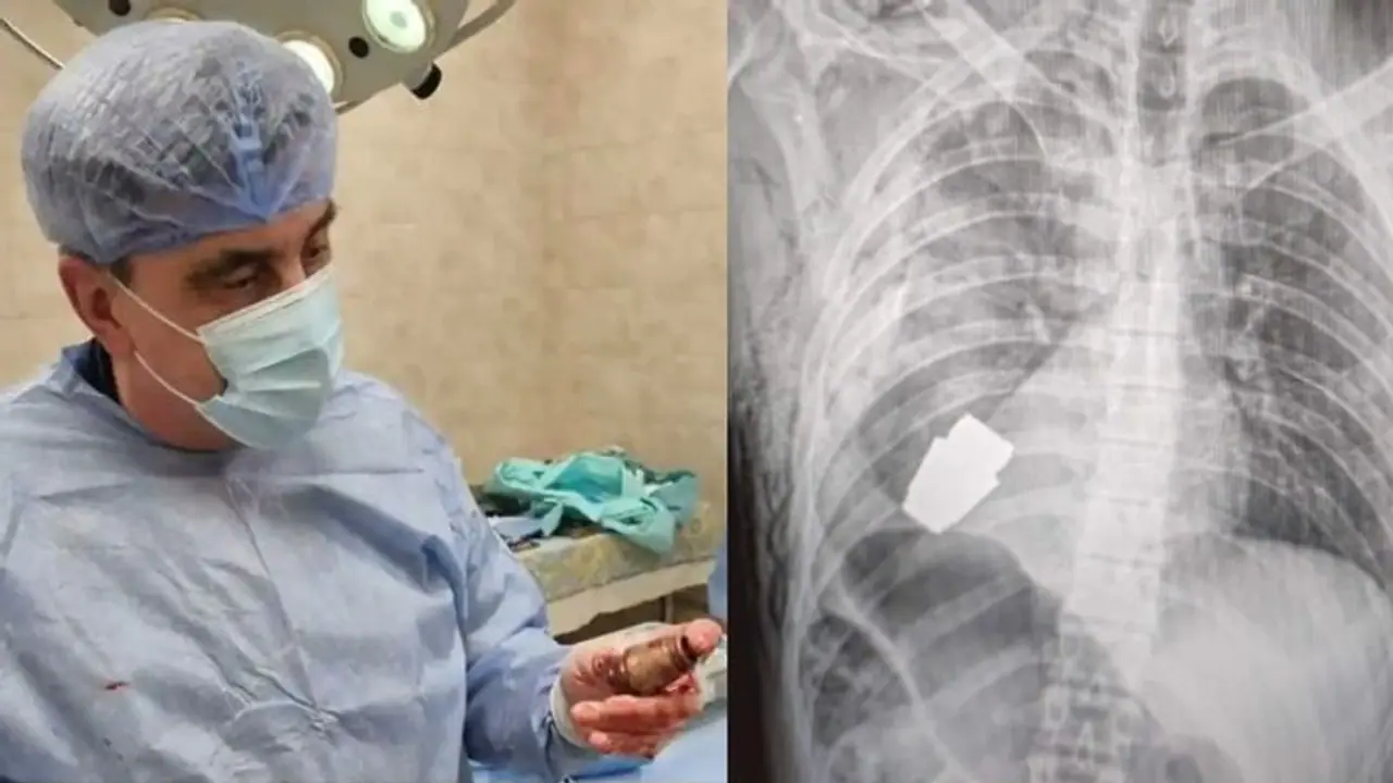 चमत्कार: सैनिक के सीने में घुसा था जिंदा ग्रेनेड, डॉक्टर ने सर्जरी कर निकाला, कभी भी हो सकता था धमाका चमत्कार: सैनिक के सीने में घुसा था जिंदा ग्रेनेड, डॉक्टर ने सर्जरी कर निकाला, कभी भी हो सकता था धमाका